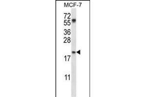 PYCARD Antibody (C-term) (ABIN657783 and ABIN2846757) western blot analysis in MCF-7 cell line lysates (35 μg/lane). (PYCARD Antikörper  (C-Term))