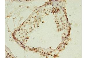 Immunohistochemistry of paraffin-embedded human testis tissue using ABIN7155356 at dilution of 1:100 (HIST1H2AG Antikörper  (AA 2-130))