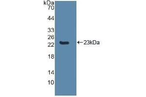 Detection of Recombinant CASP8, Human using Polyclonal Antibody to Caspase 8 (CASP8) (Caspase 8 Antikörper  (AA 217-384))