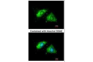 ICC/IF Image Immunofluorescence analysis of methanol-fixed HeLa, using Calnexin, antibody at 1:200 dilution.