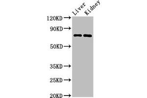 Western Blot Positive WB detected in: Mouse liver tissue, Mouse kidney tissue All lanes: PRDM5 antibody at 3 μg/mL Secondary Goat polyclonal to rabbit IgG at 1/50000 dilution Predicted band size: 74, 70, 13, 59 kDa Observed band size: 74 kDa (PRDM5 Antikörper  (AA 29-111))