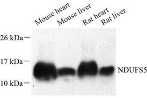 Western blot analysis of NDUFS5 (ABIN7074767) at dilution of 1: 500 (NDUFS5 Antikörper)