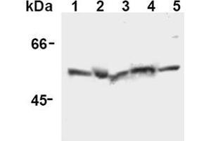 Western Blotting (WB) image for anti-Caspase 12 (Gene/pseudogene) (CASP12) (AA 95-318), (N-Term) antibody (ABIN567796) (Caspase 12 Antikörper  (N-Term))