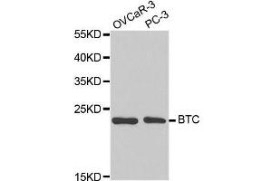 Western blot analysis of extracts of various cell lines, using BTC antibody. (Betacellulin Antikörper  (AA 32-178))