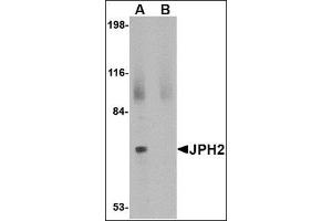 Western blot analysis of JPH2 in 293 cell lysate with this product at 2 μg/ml in (A) the absence and (B) the presence of blocking peptide. (Junctophilin 2 Antikörper  (C-Term))