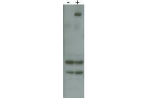 RK8 (LRRK2) Antibody  f detects over-expressed human LRRK2 protein. (LRRK2 Antikörper  (AA 878-909))