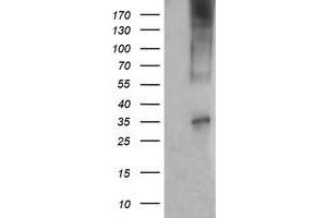 Western Blotting (WB) image for anti-T-cell surface glycoprotein CD1c (CD1C) antibody (ABIN2670660) (CD1c Antikörper)