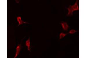 Immunofluorescence (fixed cells) (IF/ICC) image for anti-Tumor Necrosis Factor (Ligand) Superfamily, Member 12 (TNFSF12) (N-Term) antibody (ABIN6265650)