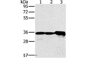 Western blot analysis of Mouse kidney tissue and Jurkat cell, mouse heart tissue, using NDUFA9 Polyclonal Antibody at dilution of 1:400 (NDUFA9 Antikörper)