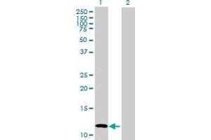 Western Blot analysis of CALCB expression in transfected 293T cell line by CALCB MaxPab polyclonal antibody. (CALCB Antikörper  (AA 1-127))