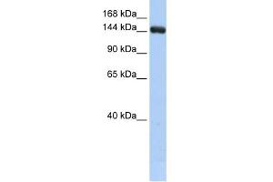 WB Suggested Anti-UGCGL2 Antibody Titration:  0. (UGCGL2 Antikörper  (Middle Region))