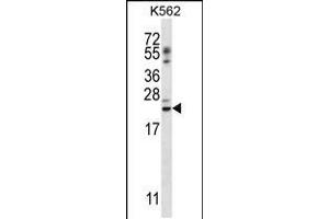 Western blot analysis in K562 cell line lysates (35ug/lane). (PSORS1C1 Antikörper  (N-Term))