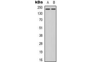 Western blot analysis of VEGFR2 (pY1214) expression in HuvEc (A), HepG2 (B) whole cell lysates. (VEGFR2/CD309 Antikörper  (C-Term, pTyr1214))
