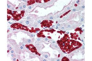 Anti-GYPA / Glycophorin A antibody IHC of human kidney, red blood cells. (CD235ab Antikörper)