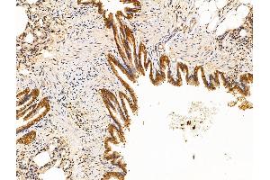 ABIN7094623 and ABIN7098673 at 1/100 staining Rat lung tissue by IHC-P.