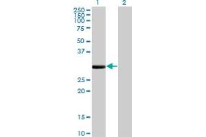 Western Blot analysis of FCN1 expression in transfected 293T cell line by FCN1 monoclonal antibody (M06), clone 2B7. (FCN1 Antikörper  (AA 201-300))