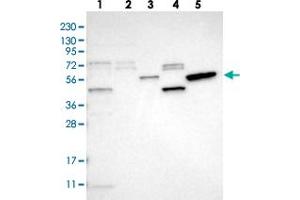 Western blot analysis of Lane 1: RT-4, Lane 2: U-251 MG, Lane 3: Human Plasma, Lane 4: Liver, Lane 5: Tonsil with SLC41A1 polyclonal antibody .