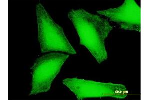 Immunofluorescence of purified MaxPab antibody to CRY2 on HeLa cell. (CRY2 Antikörper  (AA 1-593))