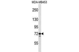 TMPO Antibody (N-term) western blot analysis in MDA-MB453 cell line lysates (35 µg/lane). (Thymopoietin Antikörper  (N-Term))