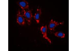Immunofluorescent analysis of RPL39 staining in HepG2 cells.