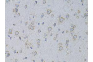 Immunohistochemistry of paraffin-embedded rat brain using GARS antibody (ABIN1876623) at dilution of 1:100 (40x lens).