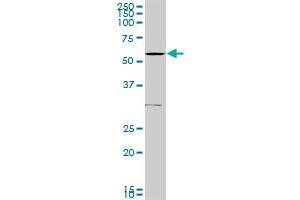 Western Blotting (WB) image for anti-Transforming Growth Factor, beta Receptor 1 (TGFBR1) (AA 30-125) antibody (ABIN563176)