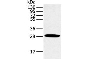 Western blot analysis of Human normal lung tissue using CLDN25 Polyclonal Antibody at dilution of 1:250 (CLDN25 Antikörper)