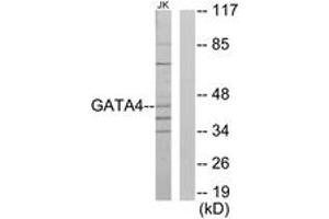 Western Blotting (WB) image for anti-GATA Binding Protein 4 (GATA4) (AA 271-320) antibody (ABIN2889481) (GATA4 Antikörper  (AA 271-320))