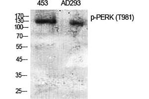 Western Blot analysis of 453(1), AD293(2), diluted at 1:2000. (PERK Antikörper  (pThr981))