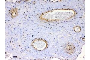 IHC testing of FFPE human placenta tissue with VEGFR2 antibody at 1ug/ml. (VEGFR2/CD309 Antikörper)