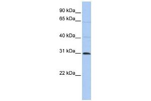C1ORF184 antibody used at 1 ug/ml to detect target protein. (METTL11B Antikörper  (C-Term))