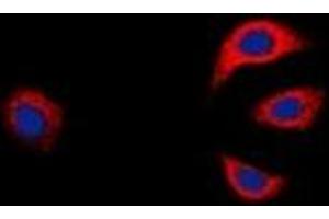 Immunofluorescent analysis of GAB1 staining in K562 cells. (GAB1 Antikörper  (C-Term))