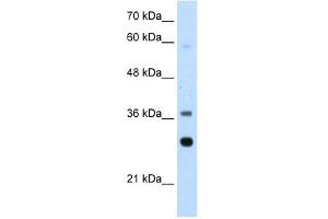 RPLP0 antibody used at 2. (RPLP0 Antikörper  (Middle Region))