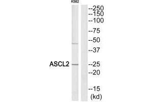 Western blot analysis of extracts from K562 cells, using ASCL2 antibody. (ASCL2 Antikörper)