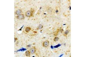 Immunohistochemical analysis of Alpha-1A Adrenergic Receptor staining in human brain formalin fixed paraffin embedded tissue section.