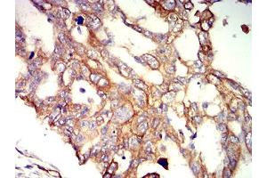 Immunohistochemistry (IHC) image for anti-APC Regulator of WNT Signaling Pathway 2 (APC2) (AA 2041-2181) antibody (ABIN5611232)