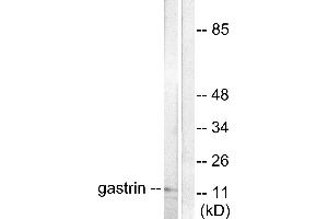 Western blot analysis of extracts from NIH/3T3 cells, using Gastrin antibody (#C0205). (Gastrin Antikörper)