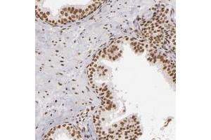 Immunohistochemical staining of human prostate with PAPOLA polyclonal antibody  shows moderate nuclear positivity in glandular cells at 1:50-1:200 dilution. (PAPOLA Antikörper)