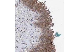 Immunohistochemical staining of human urinary bladder with PFAS polyclonal antibody  shows moderate cytoplasmic positivity in urothelial cells. (PFAS Antikörper)