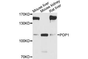 Western blot analysis of extracts of various cell lines, using POP1 antibody (ABIN5973549) at 1/1000 dilution. (POP1 Antikörper)