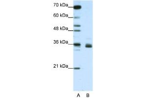 WB Suggested Anti-HNRNPA1L2 Antibody Titration:  1. (HNRNPA1L2 Antikörper  (N-Term))
