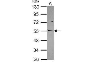 WB Image Sample (30 ug of whole cell lysate) A: NT2D1 10% SDS PAGE antibody diluted at 1:1000 (MMP13 Antikörper)