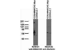 Transfected cell immunoblot: extracts of COS cells transiently transfected with Myc-tagged MMACHC or untagged Kv2.