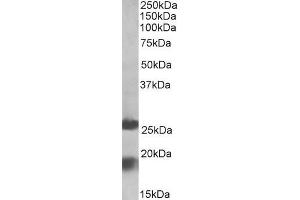 ABIN571250 (2µg/ml) staining of Human Frontal Cortex lysate (35µg protein in RIPA buffer). (MPV17 Antikörper  (Internal Region))