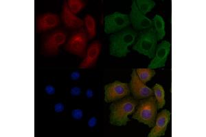 ABIN6260457 and ABIN6278556 staining Hela cells by IF/ICC. (CARD10 Antikörper  (N-Term))