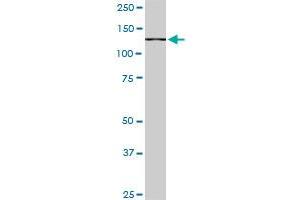 CAND1 monoclonal antibody (M05), clone 1G5. (CAND1 Antikörper  (AA 1-100))