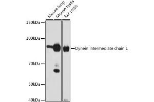 Western blot analysis of extracts of various cell lines, using Dynein intermediate chain 1 antibody (ABIN1681261, ABIN7101535, ABIN7101536 and ABIN7101537) at 1:1000 dilution. (DNAI1 Antikörper)