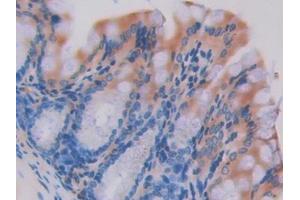 Used in DAB staining on fromalin fixed paraffin- embedded intestine tissue (HEXB Antikörper  (AA 294-435))