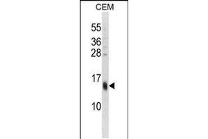 Western blot analysis in CEM cell line lysates (35ug/lane). (SPRR3 Antikörper  (C-Term))