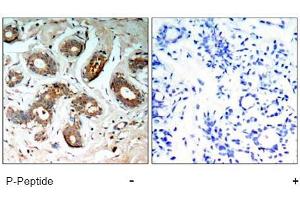 Image no. 1 for anti-14-3-3 zeta (YWHAZ) (pSer58) antibody (ABIN196916) (14-3-3 zeta Antikörper  (pSer58))